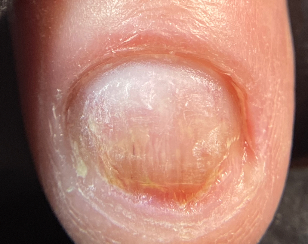 Обработка ногтя