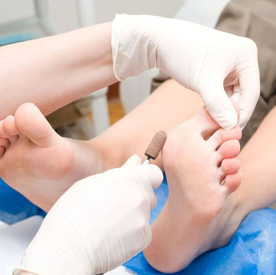 Мужской педикюр (стопы и пальцы)