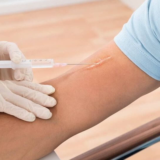 Коррекция рубцов инъекционная