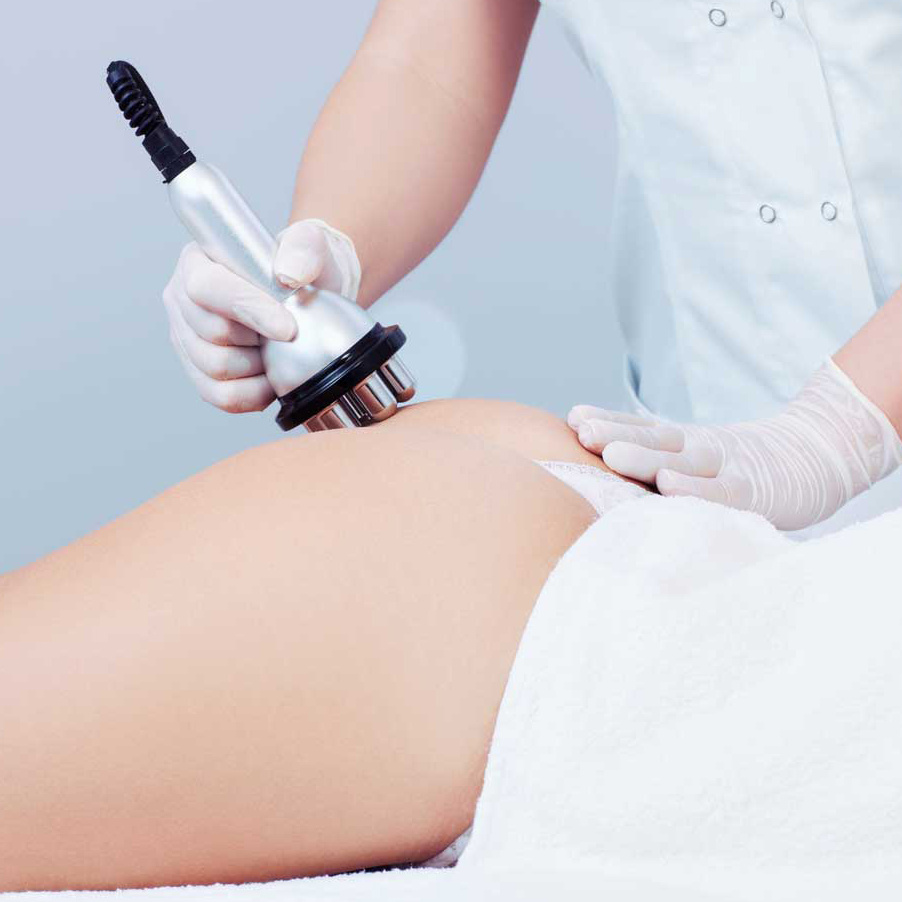 Rf-лифтинг ягодиц