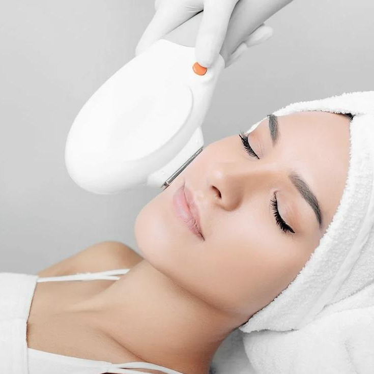 Лечение акне (IPL) декольте