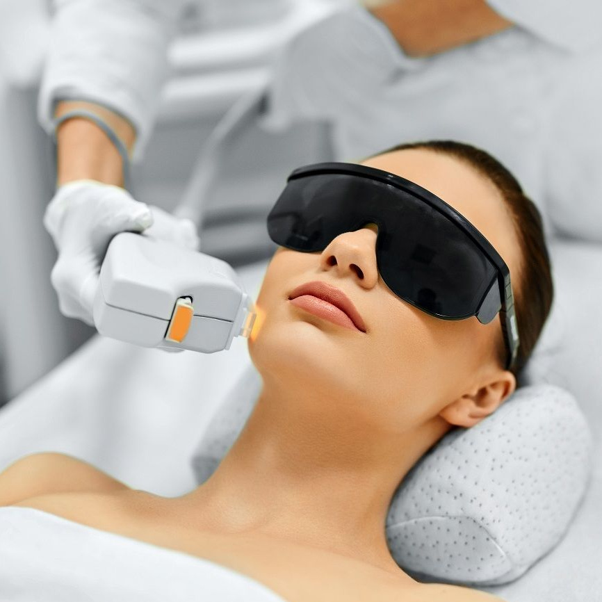 Фотоомоложение лица и шеи