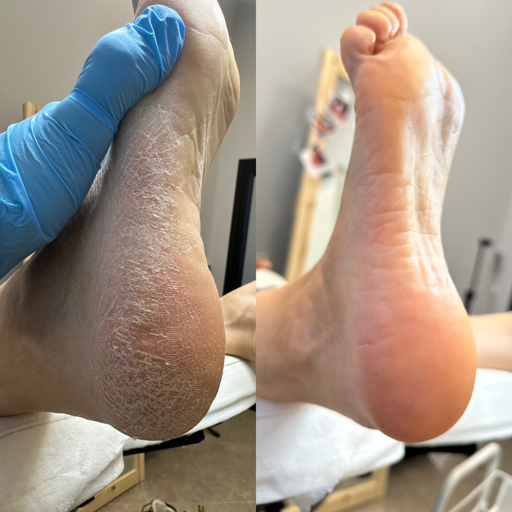 Аппаратный педикюр женский