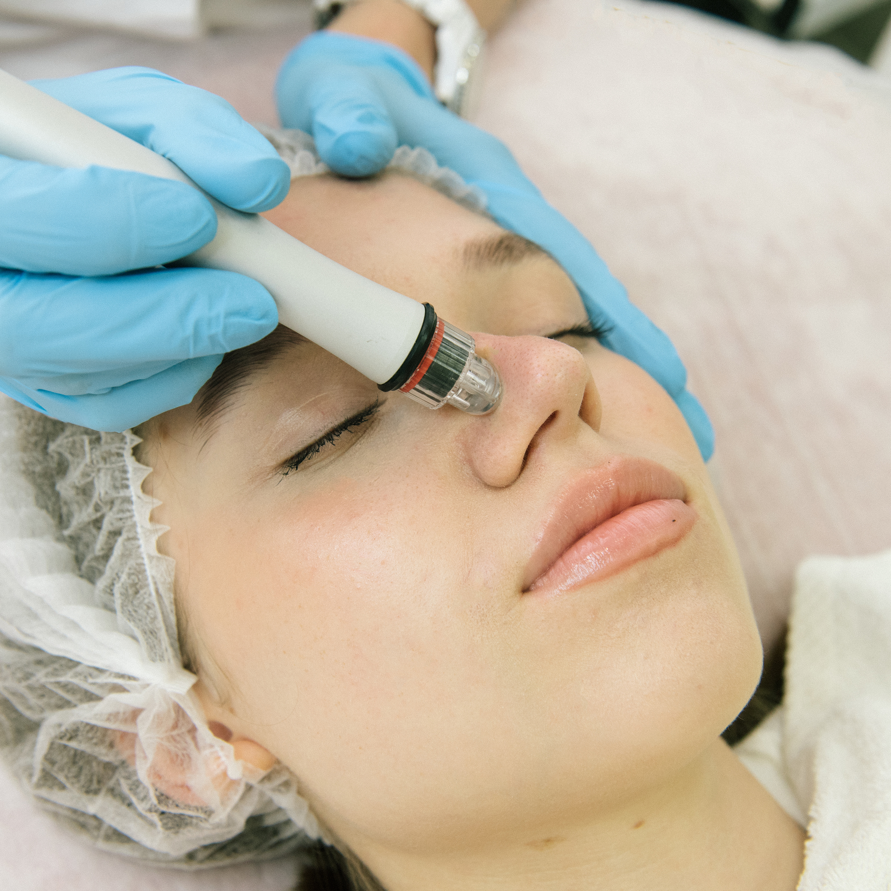 Гидропилинг ( голливудская чистка Hydra Peel)