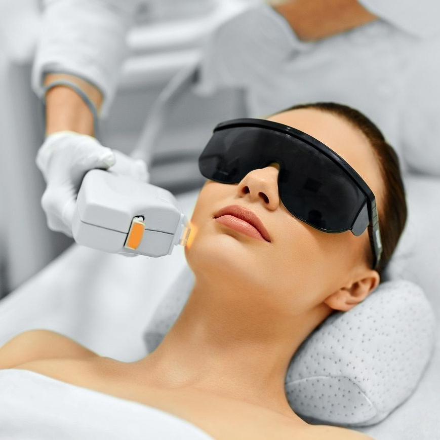 Фотоэпиляция бакенбардов