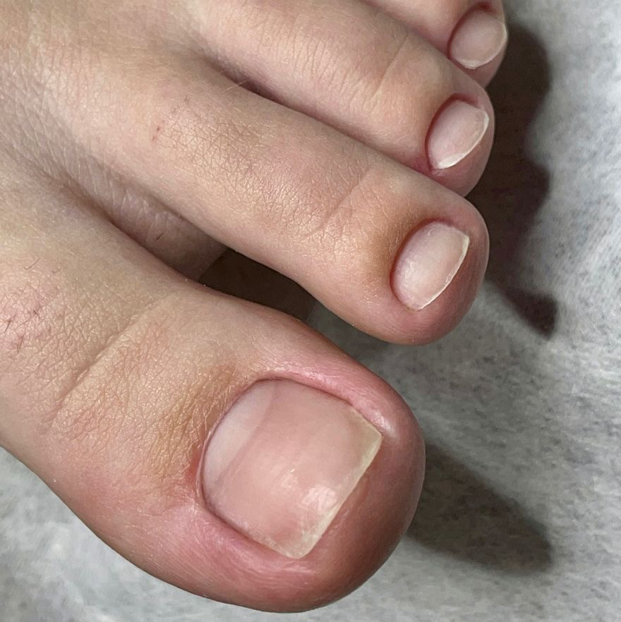 Мужской Smart педикюр (обработка стоп без пальчиков)