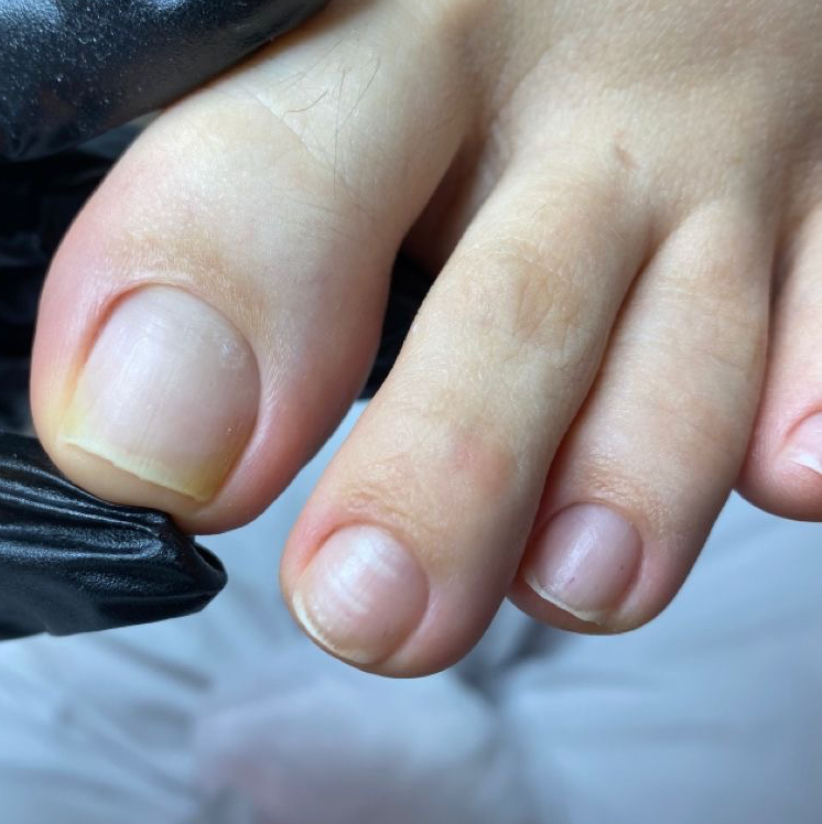 Мужской Smart педикюр (обработка пальчиков и стоп)