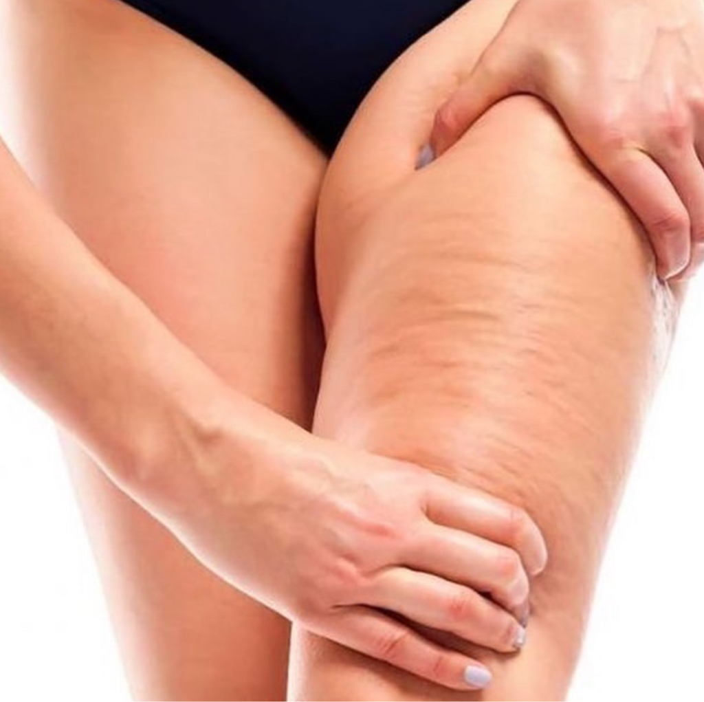 Программа «УПРУГОСТЬ Экспресс» (Обёртывание STYX + антицеллюлитный массаж проблемных зон 30 мин)