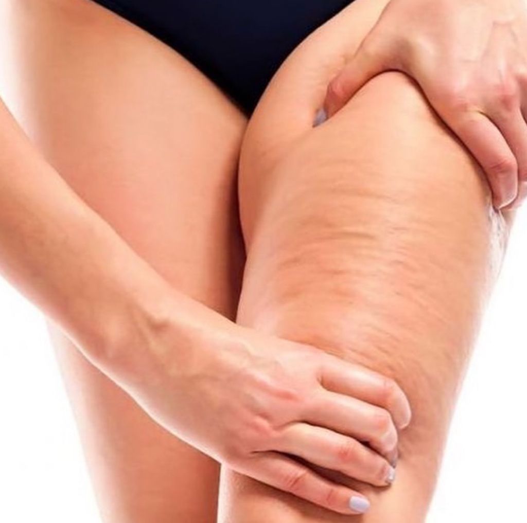 Программа «УПРУГОСТЬ» (Обёртывание STYX + антицеллюлитный массаж проблемных зон 60 мин)