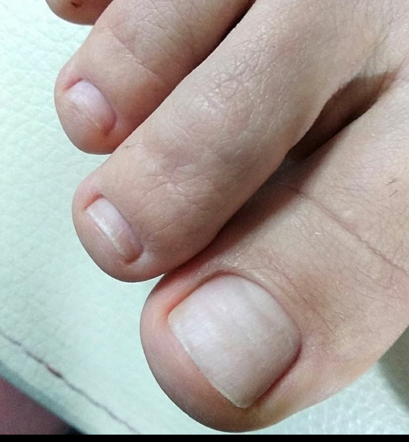 Педикюр без покрытия (только пальчики)