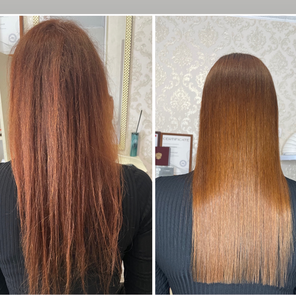 Ботокс классический  Холодный ботокс