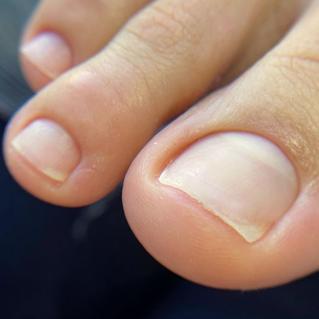 Педикюр (обработка пальчиков)