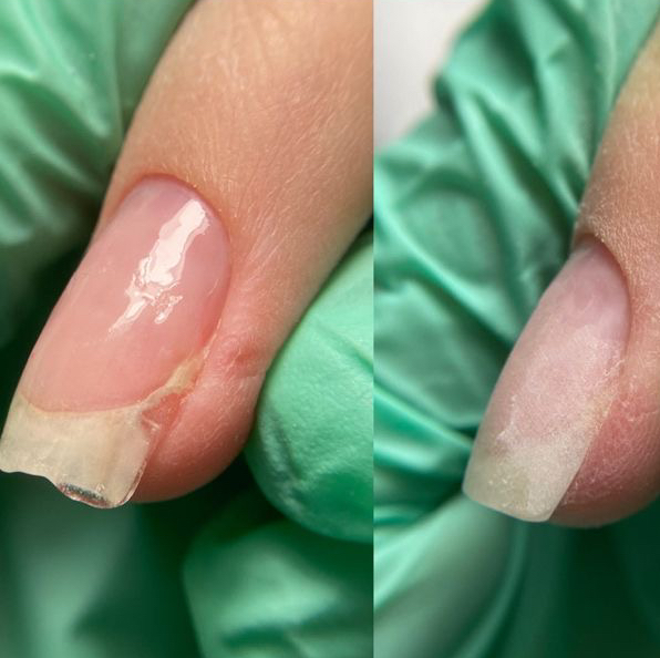 Ремонт 1 ногтя