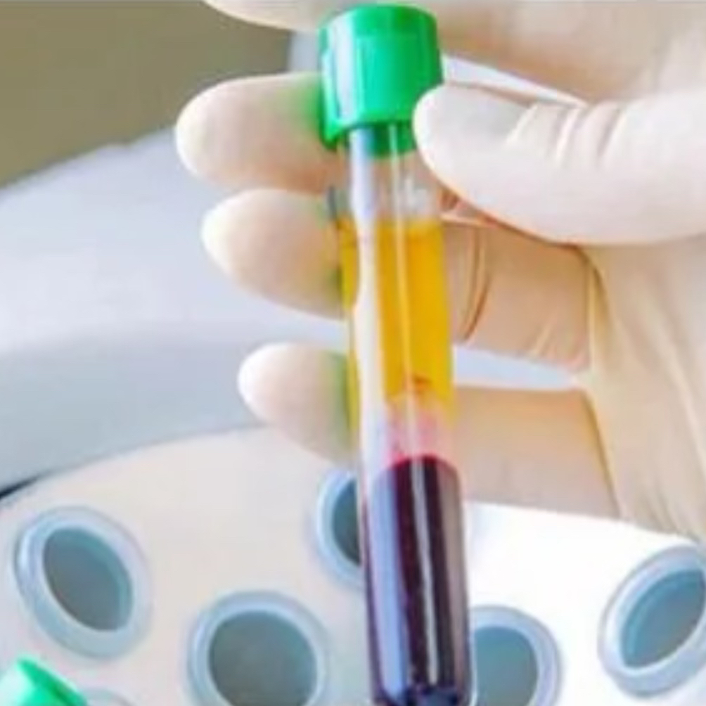 Плазмолифтинг