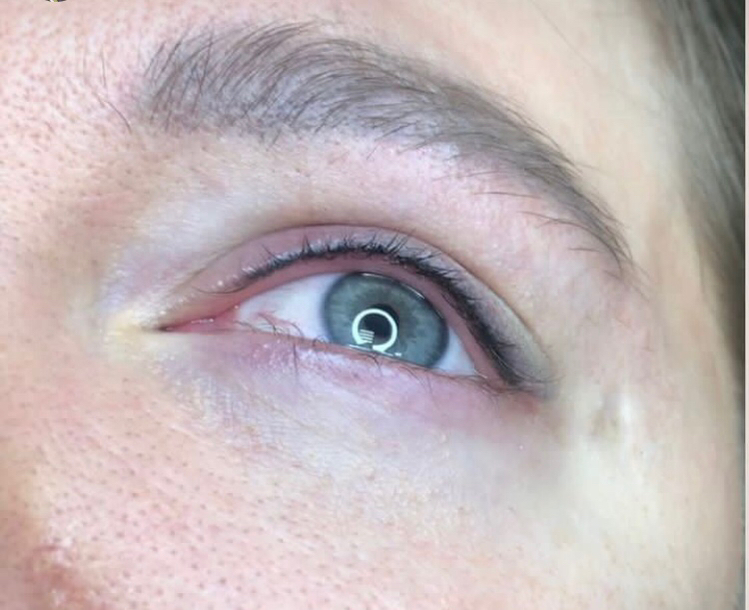Перманентный макияж межресничка