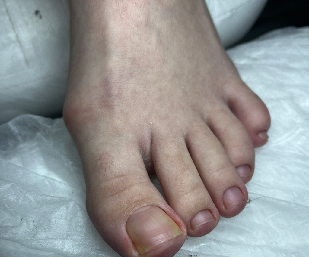 Педикюр без покрытия без стоп