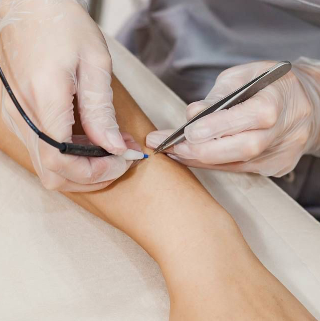 Руки и ноги полностью