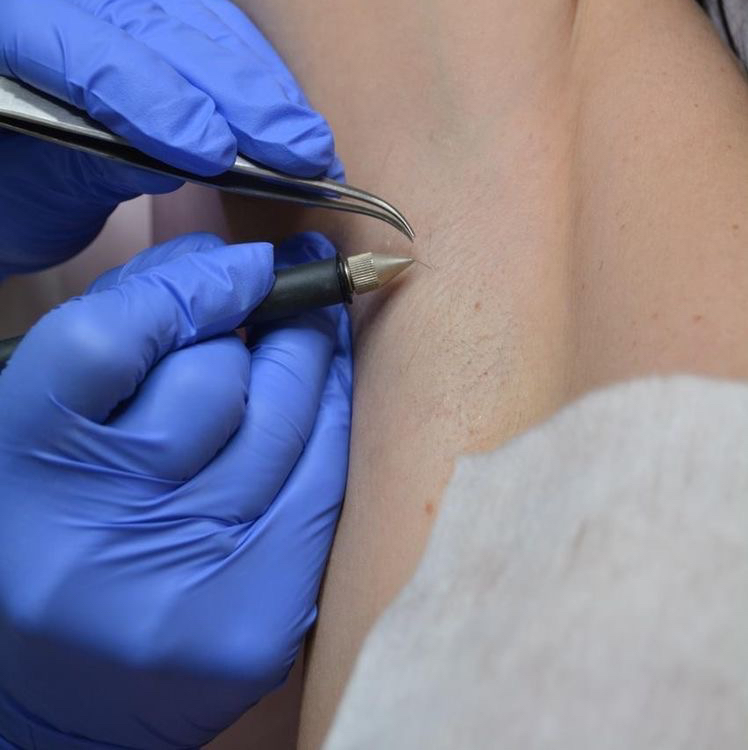 Подмышки, не глубокое бикини, грудь, живот, пальцы, ягодицы, спина