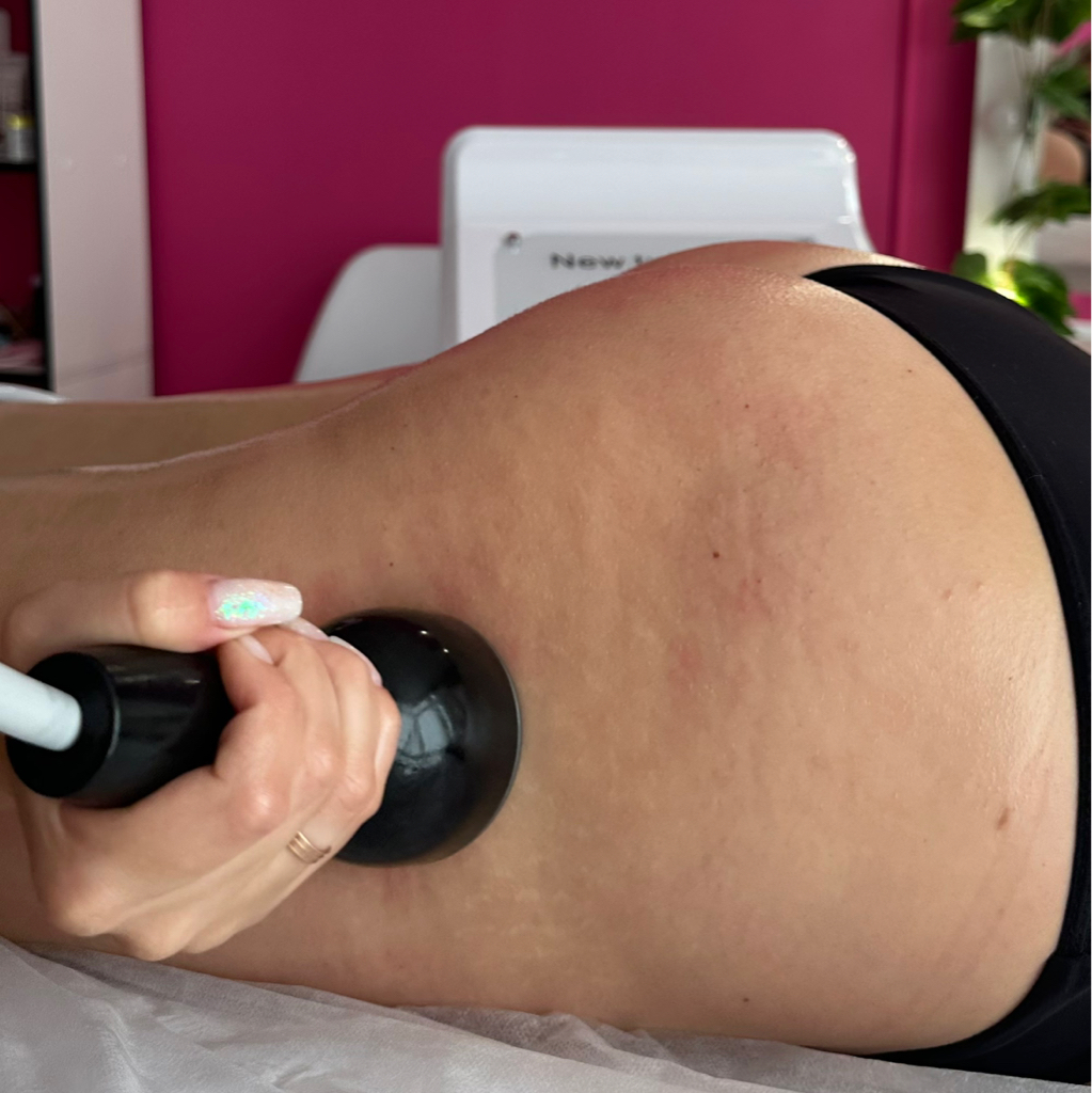 Турбо вибро массаж всего тела  + вакуумный массаж всего тела + RF лифтинг всего тело. Максимальный комплекс для интенсивной проработки проблемных зон.