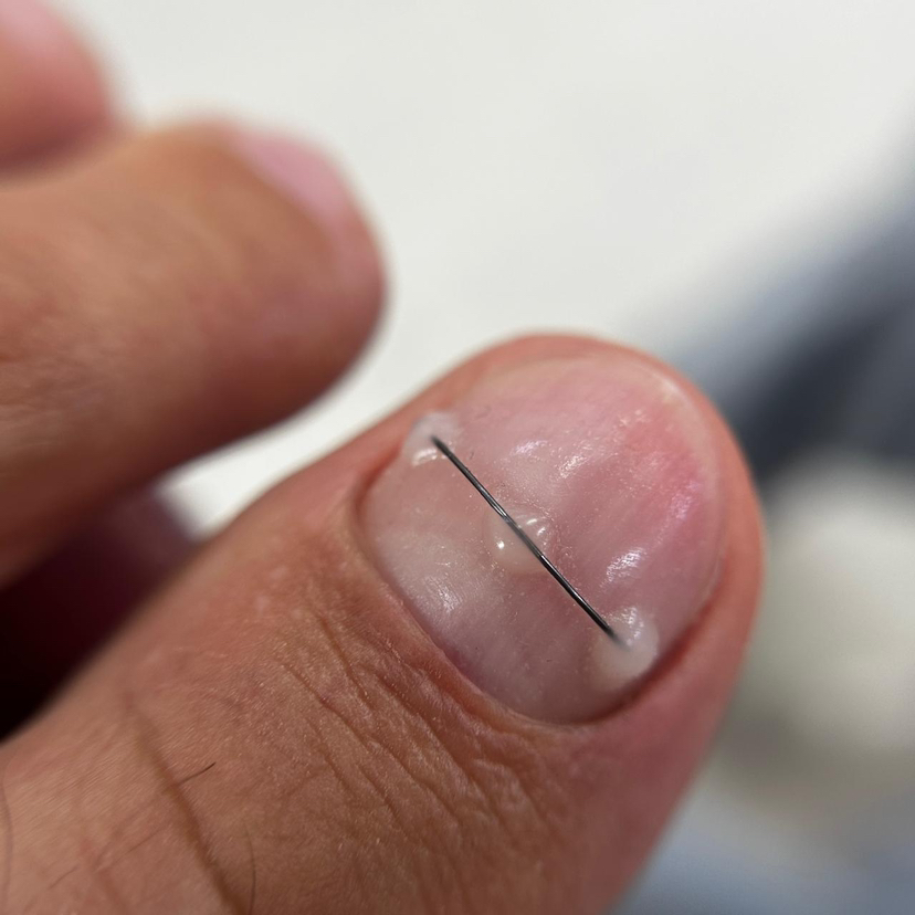 Титановая нить 1 пальчик