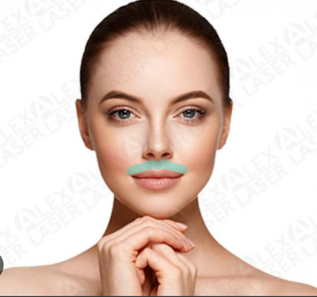 Женщины:  Александритовый аппарат:  Верхняя губа