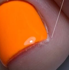 Установка тампонады