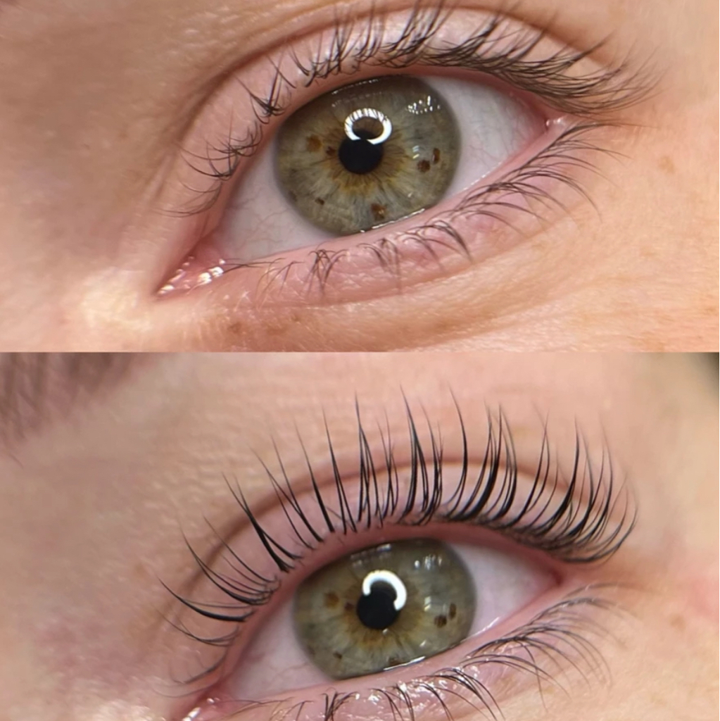 Итальянское восстановление с использованием InLei Lash Filler.
