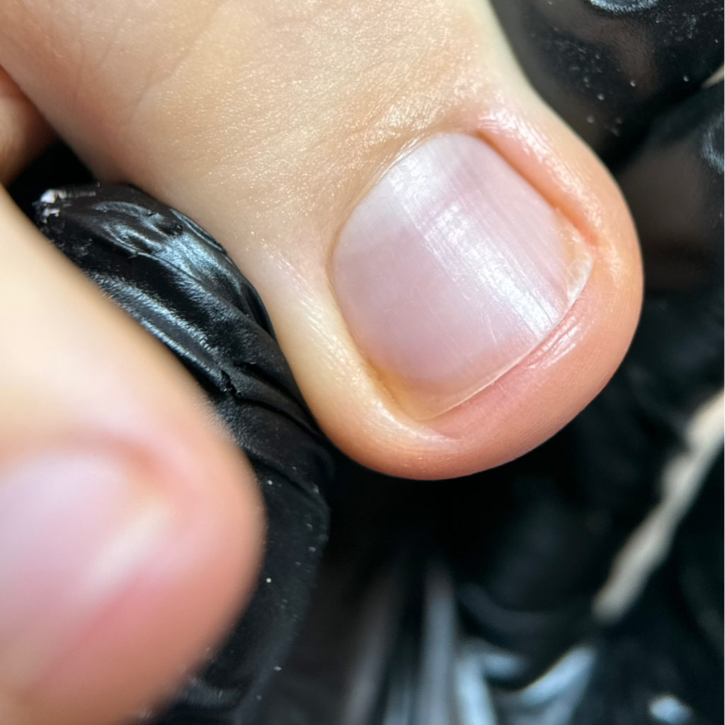 Обработка пальцев ног без покрытия