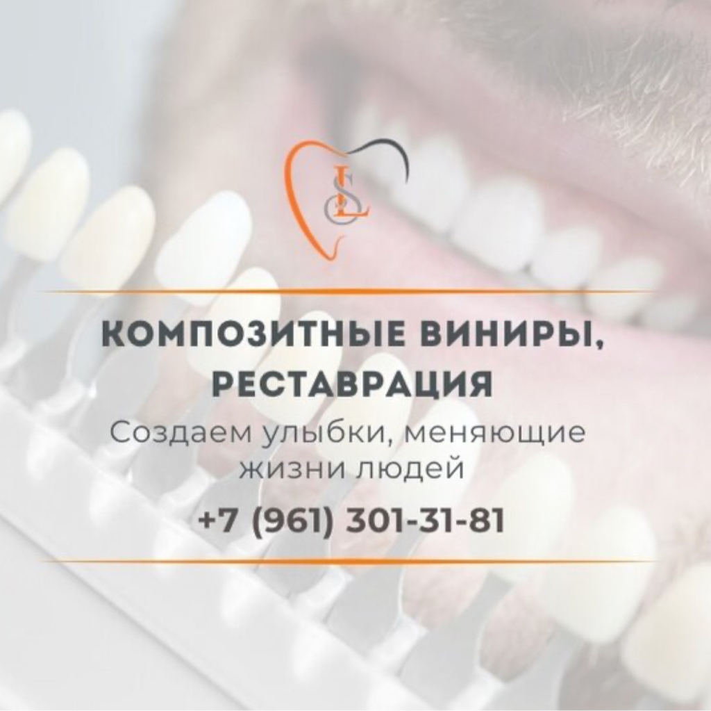Композитные виниры,реставрация.
