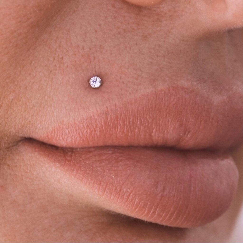 Прокол Монро