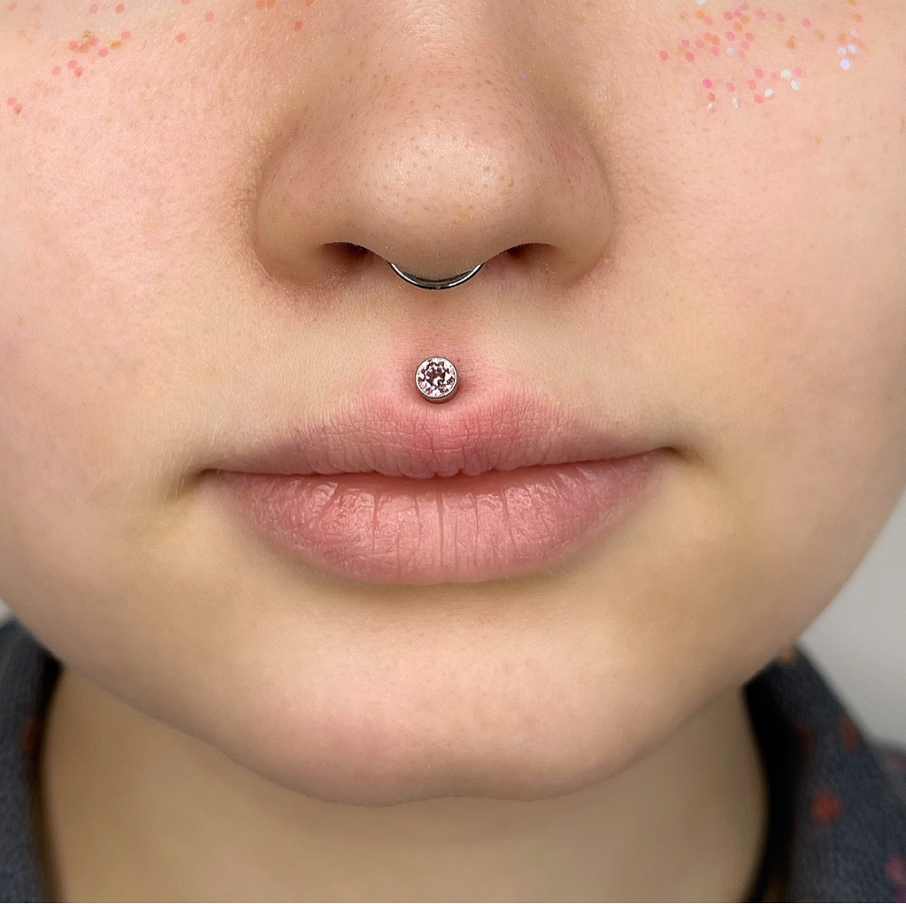 Прокол Медуза