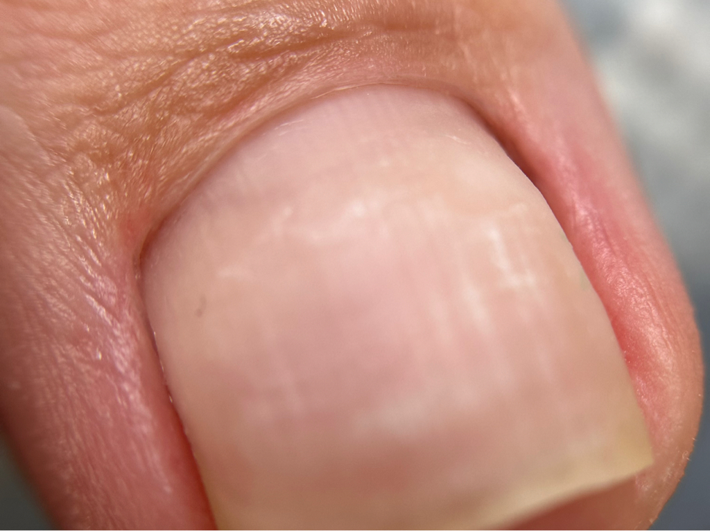 Эстетический педикюр(дисковая обработка стоп) без покрытия