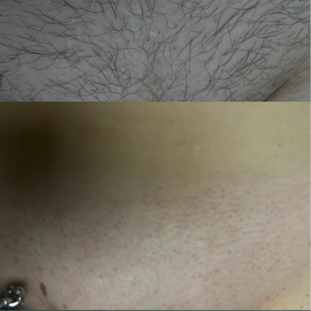 Бикини Тотал Воск