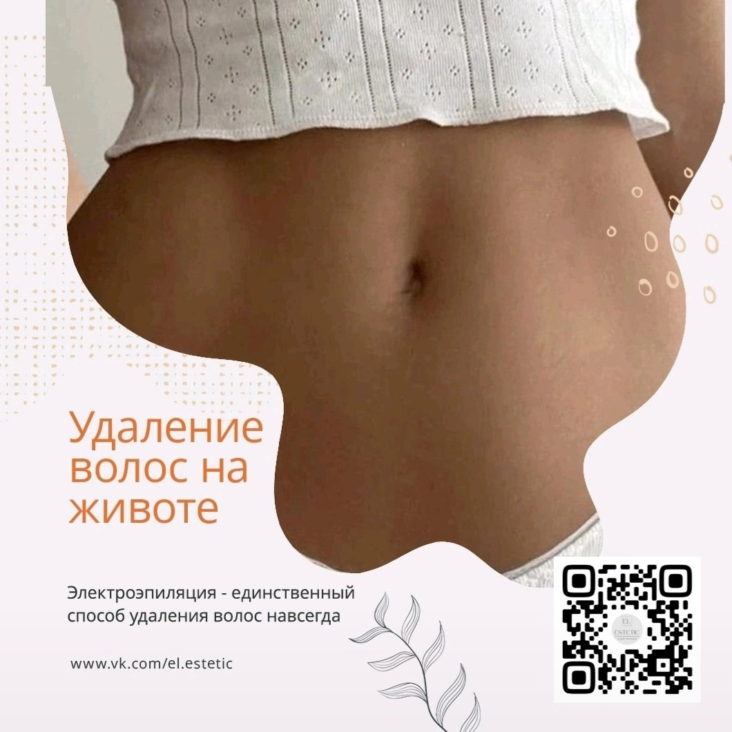 Электроэпиляция живот.