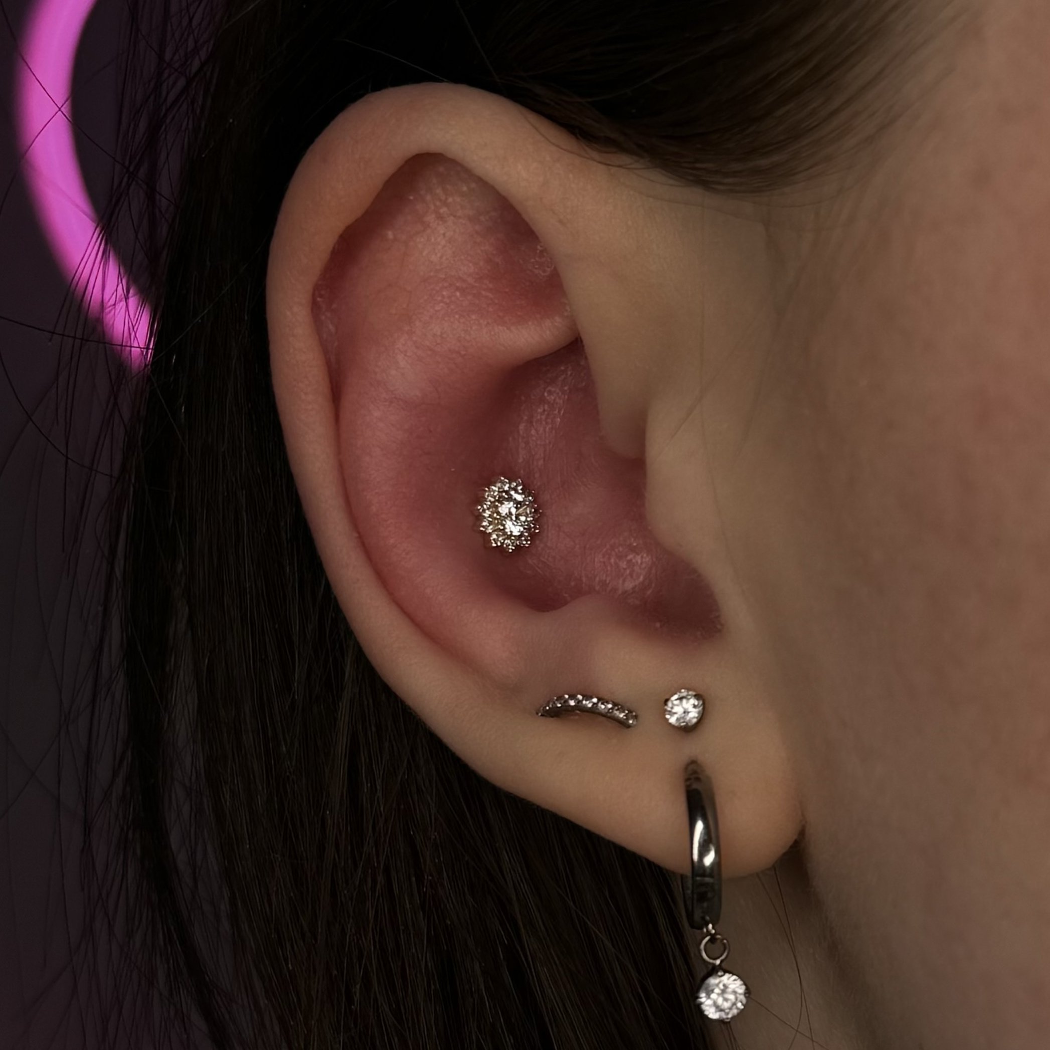 Восстановление прокола