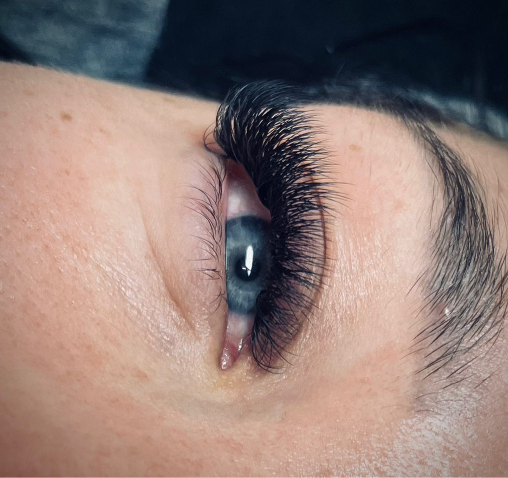 Объемное наращивание 3D/3,5D