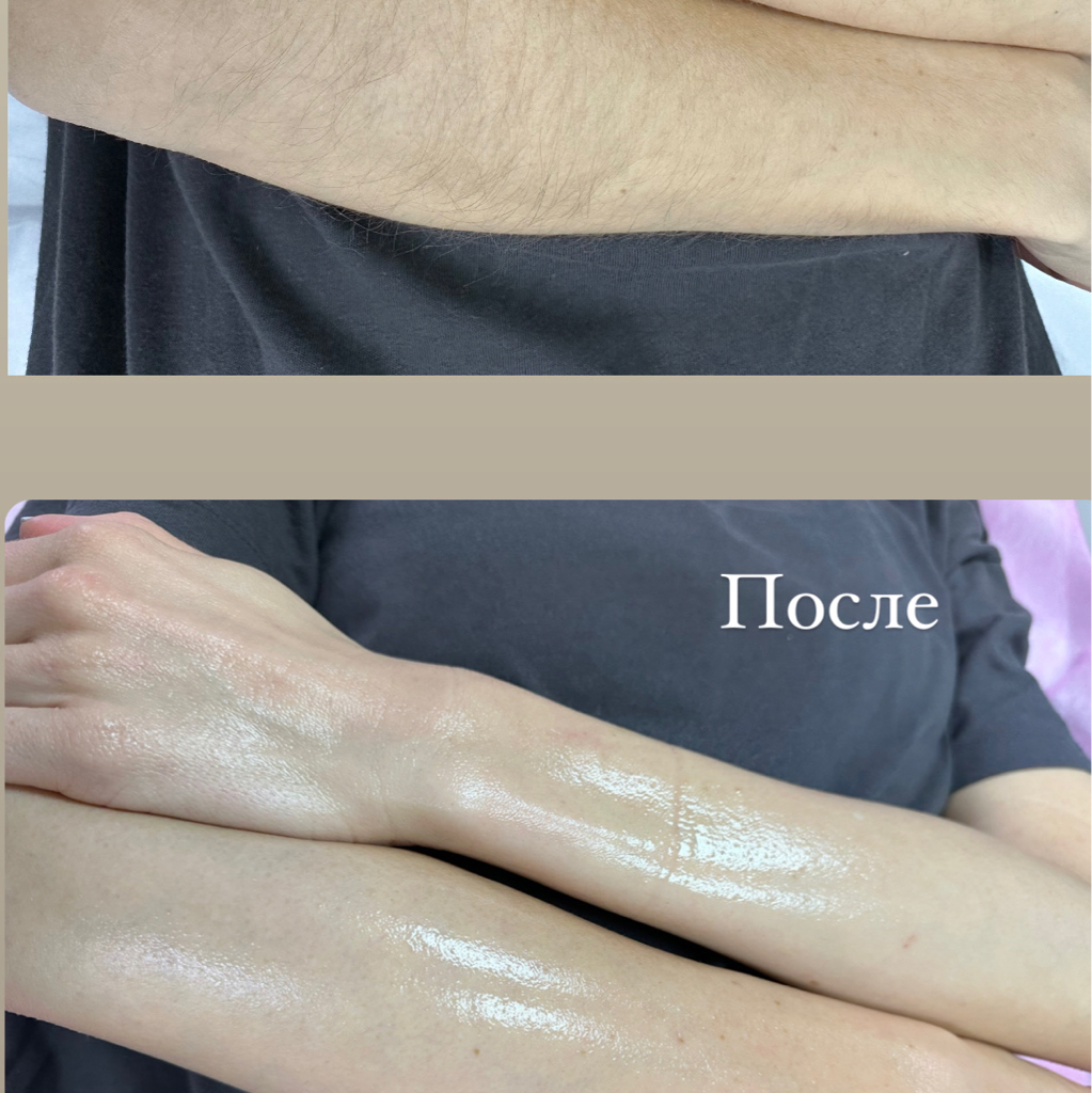 Руки полностью Skin’s