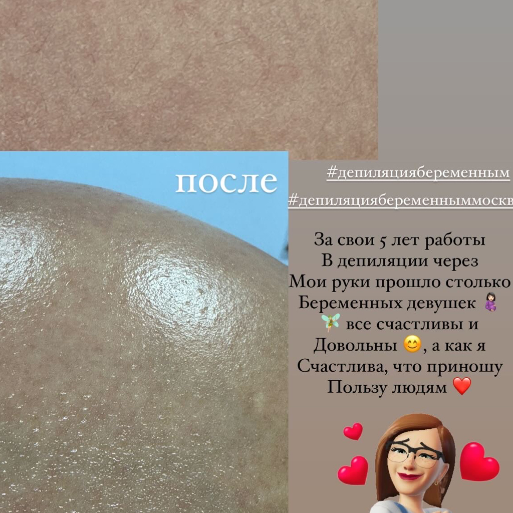 Живот полностью Skin’s