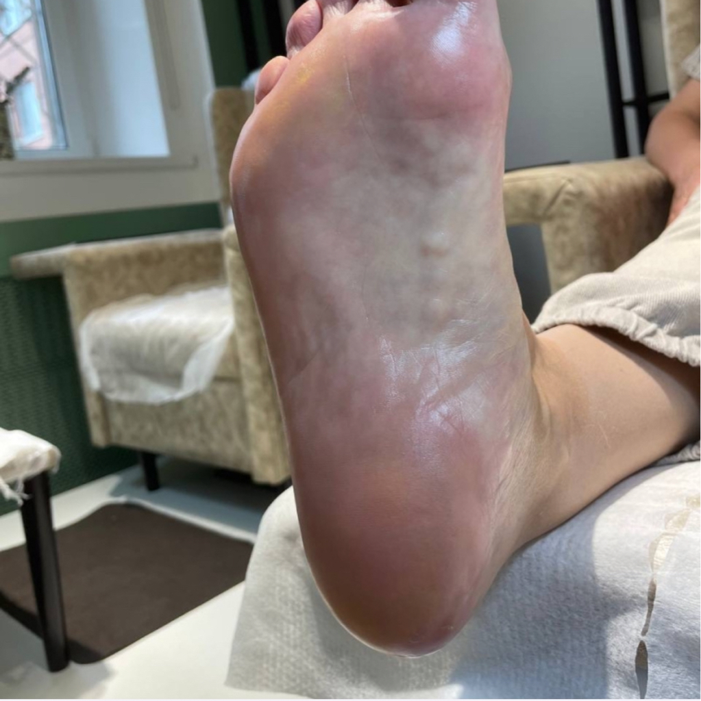 Педикюр мужской обработка стоп