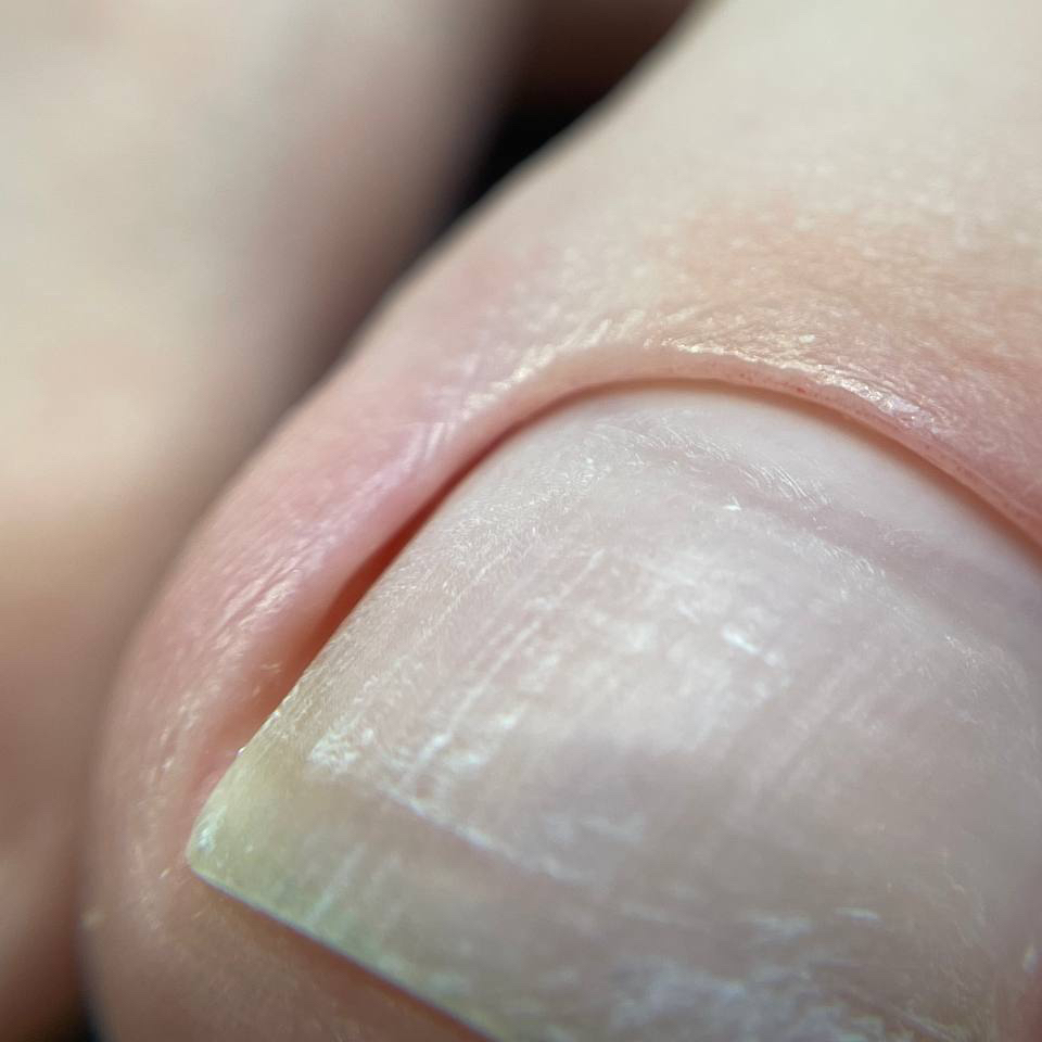 Педикюр обработка пальчиков