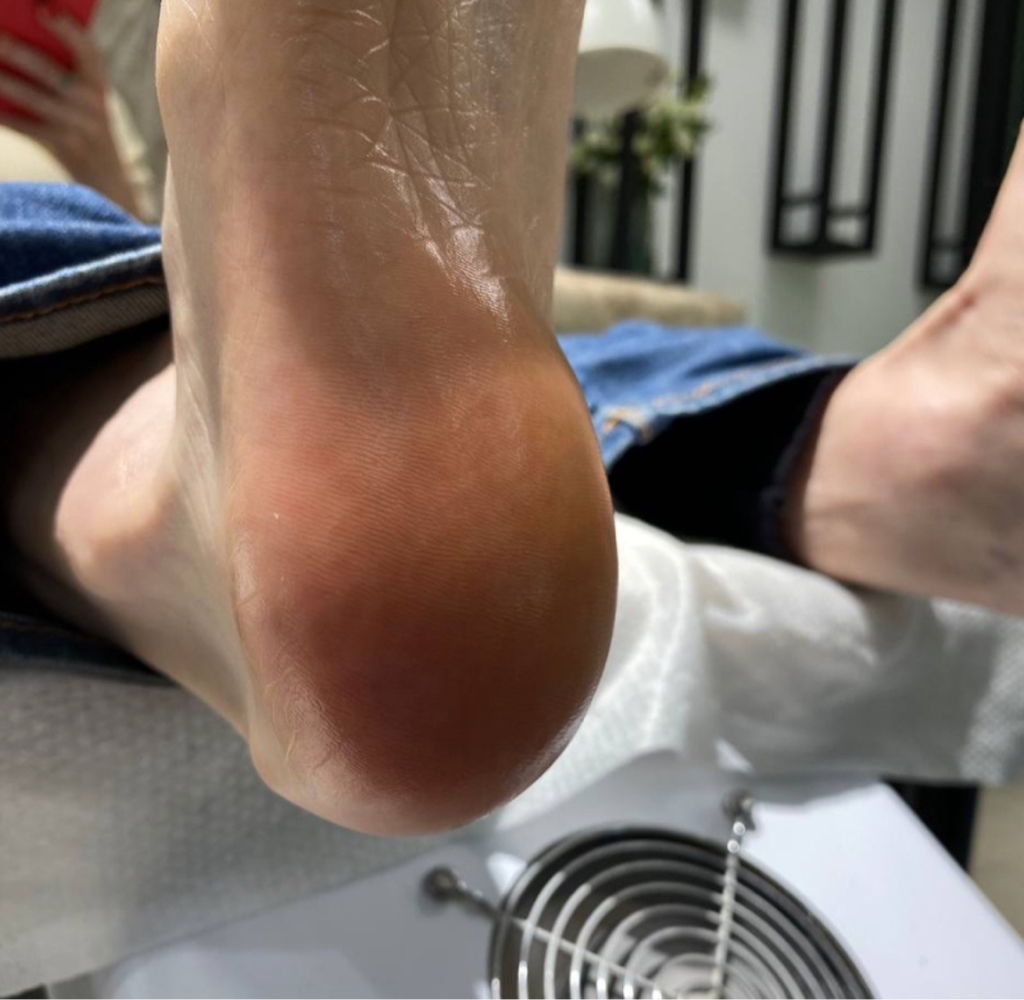 Педикюр обработка стоп