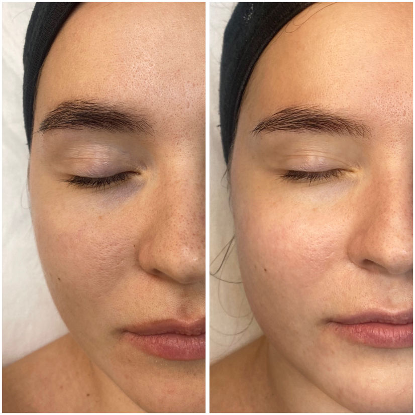 ROYAL GLOW set (Королевское свечение) Программа направленная на осветление, антиоксидантный эффект и поверхностное разглаживание морщин.