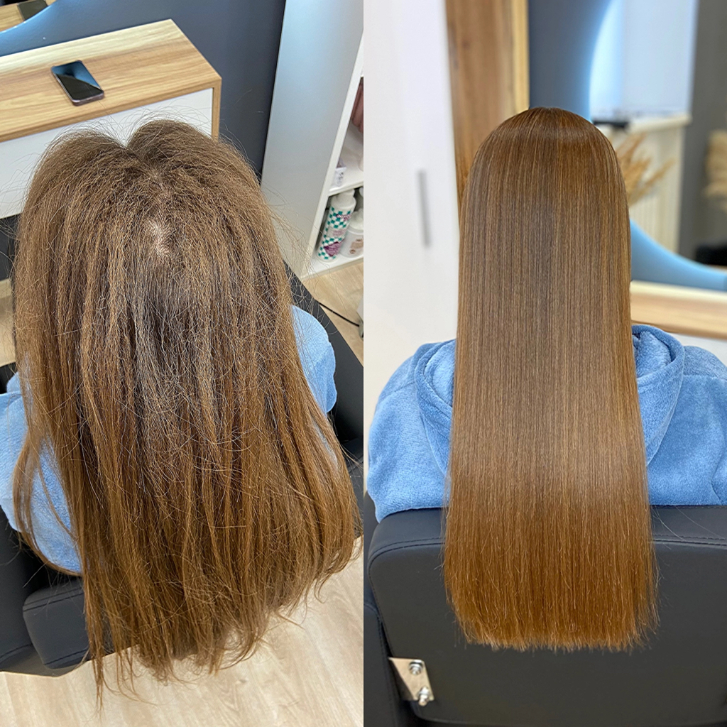 Антибустап (антиприкорневой объем)