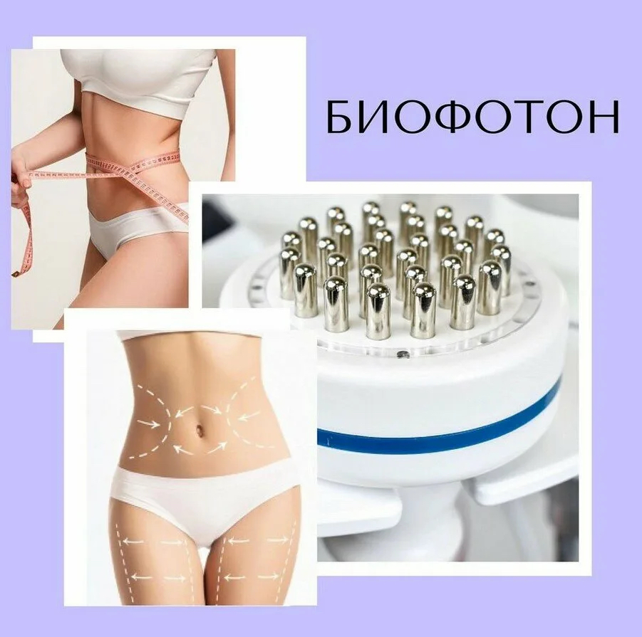 Миостимуляция (БиоФотон)