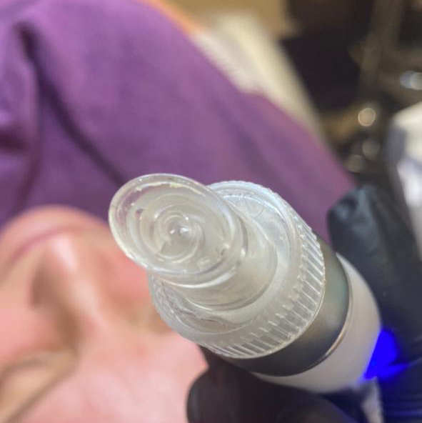 Вакуумный гидропилинг +уход