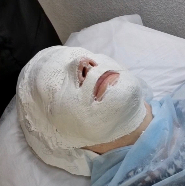 FlaxSculpt (пептидное армирование лица)