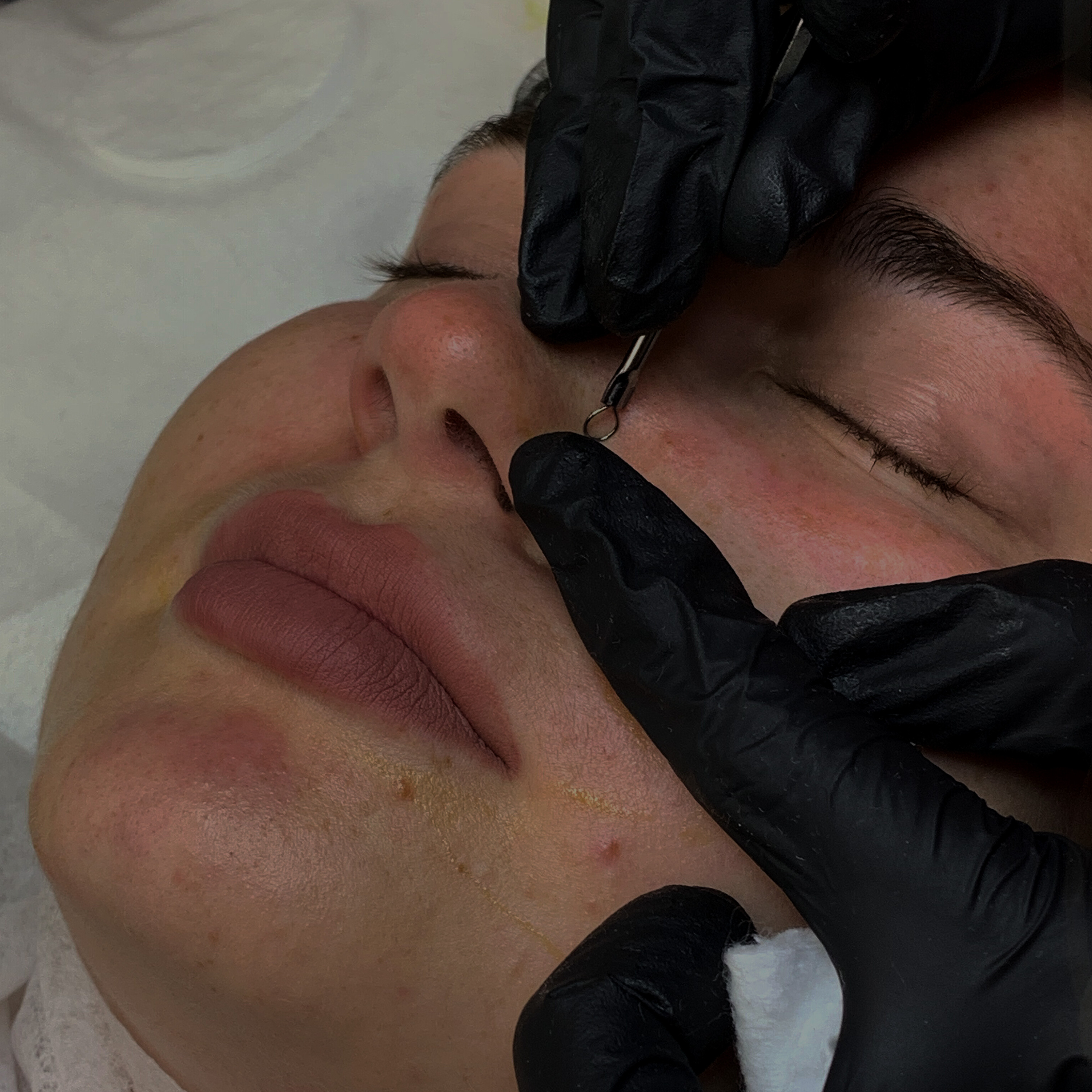 Комбинированная чистка лица