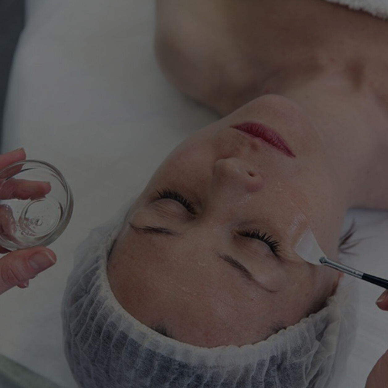 Карбокситерапия безинъекционная