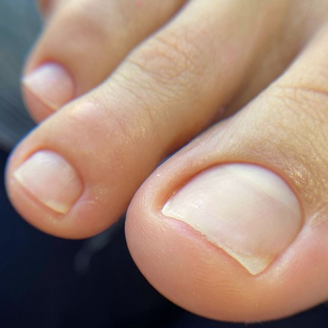 ПЕДИКЮР SMART без покрытия (стопы+пальчики)