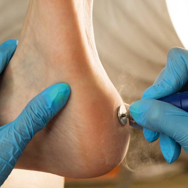 ПЕДИКЮР SMART (покрытие включено )